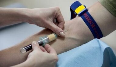 Чӣ гуна ба тести паразитҳо тайёрӣ
