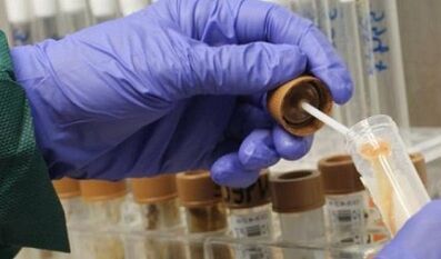 зарурати гузаштани таҳлили паразитҳо