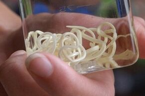 Паразитҳо аз бадани инсон