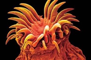 Паразитҳои трамвай дар одамон