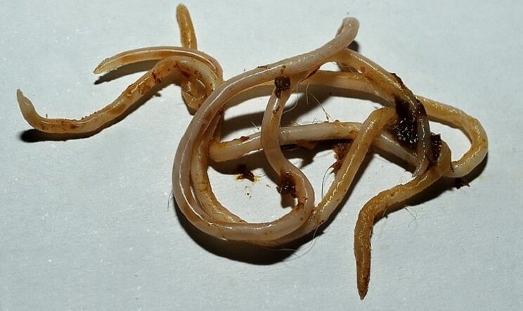 toxoca аз бадани инсон