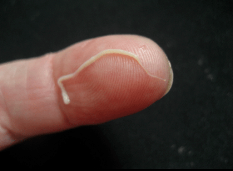 Паразитҳои мудаввар аз бадани инсон